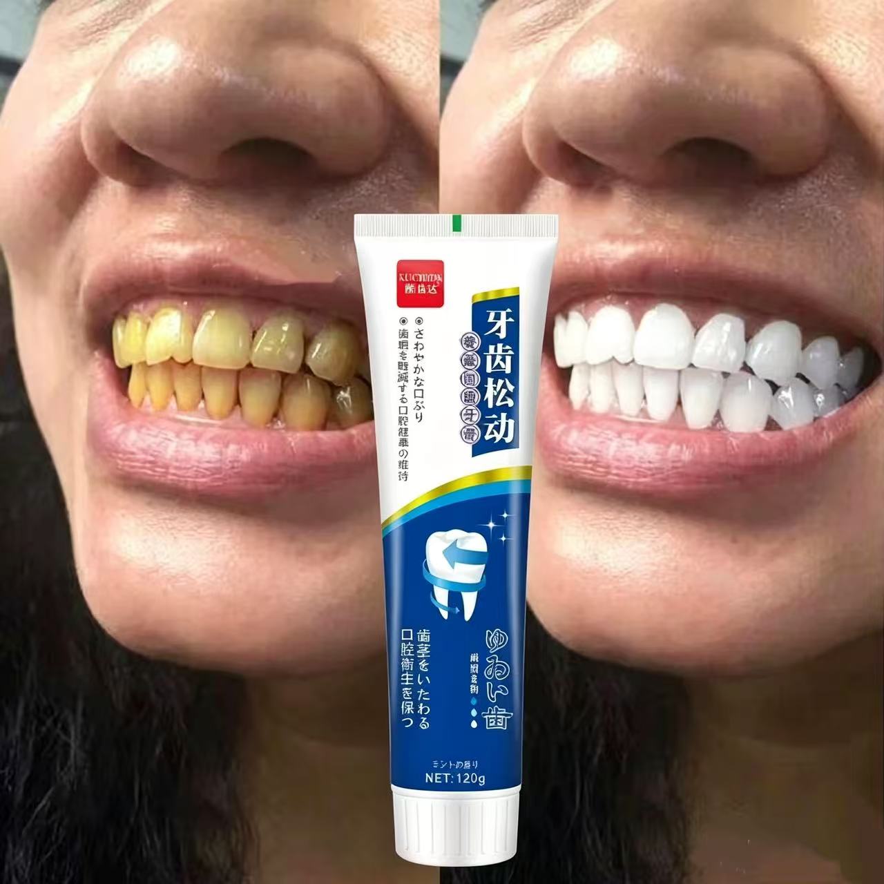 Teeth Whitening Japan - 느슨한 치아를 고치는 일본 수입 치약,