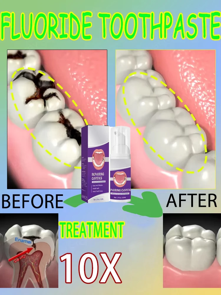 Teeth Whitening That Works - 과학적인 공동 수리, 공동 제거, 플라크