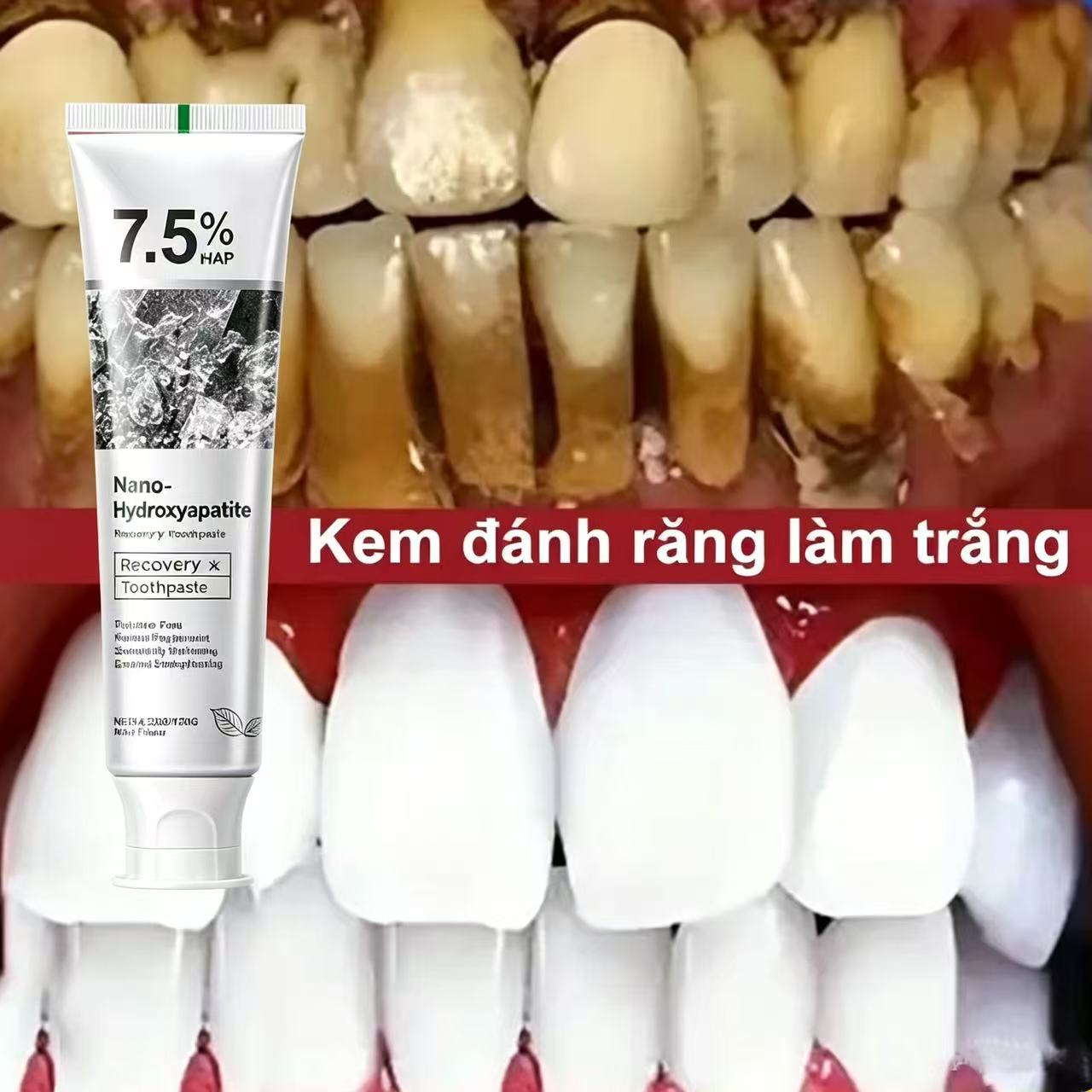 Teeth Whitening That Works - 7.5% 하이드록시아파타이트 프로바이오틱 미백 치약 에나멜