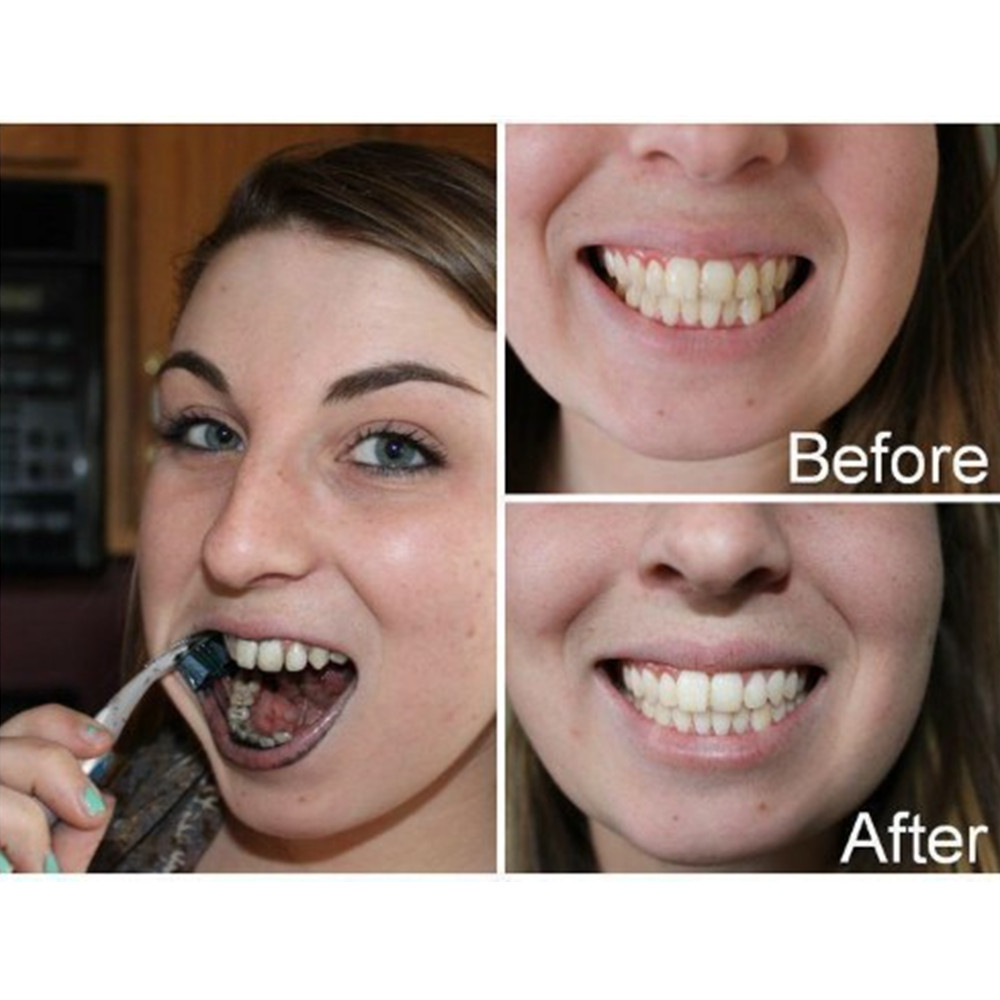 대나무 숯 치아 치아 Dentis Lab 구강 위생 관 - Teeth Whitening Kit 리뷰 및 가격
