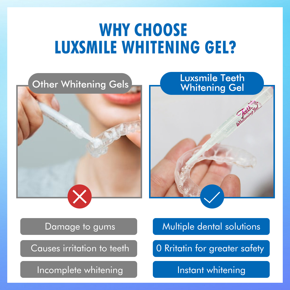 치아 미백 젤 PAP 또는 35%CP 치아 미백 젤 구 - Teeth Whitening Kit 리뷰 및 가격