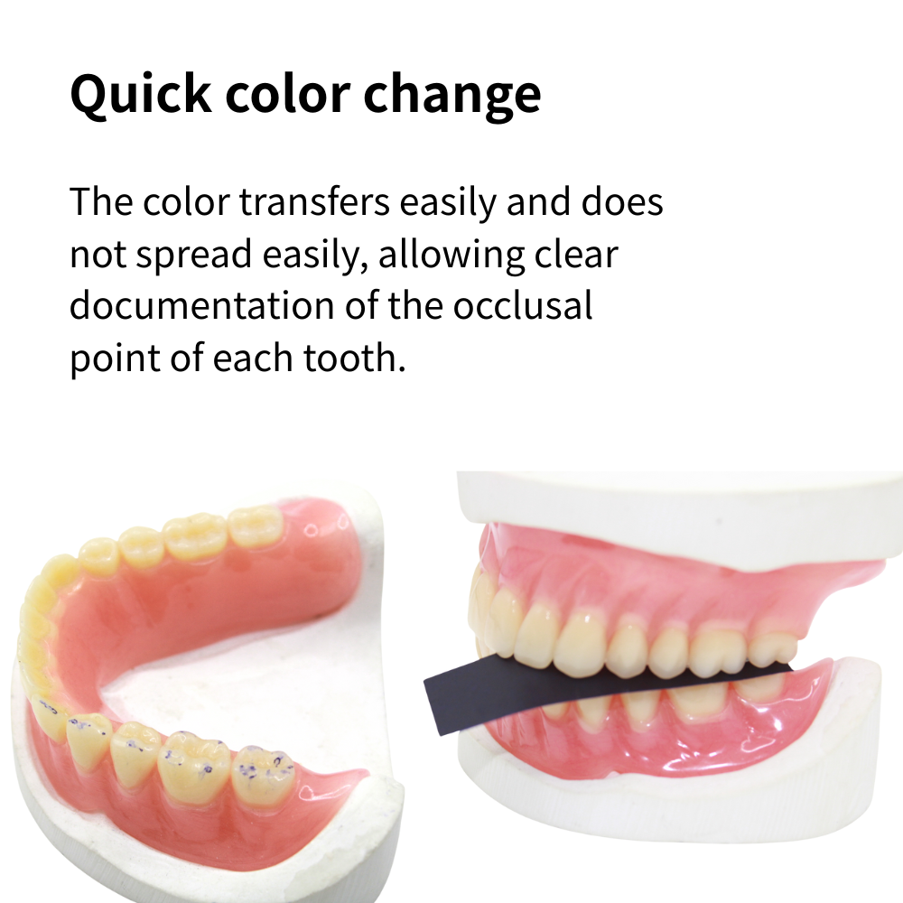 AG 300매/박스 치과용 교합지 레드/블루 치과 기공 - Teeth Whitening Kit Professional 리뷰 및 가격
