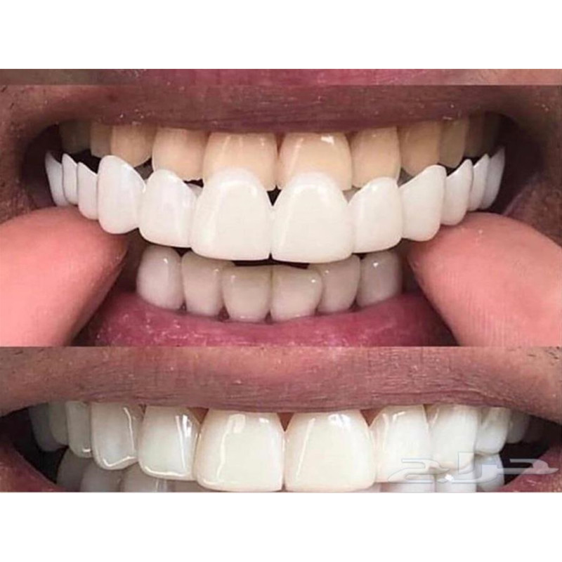 부드러운 실리콘 젤 치과 구강 상부 하부 가짜 틀니 커 - Teeth Whitening Moulds 리뷰 및 가격
