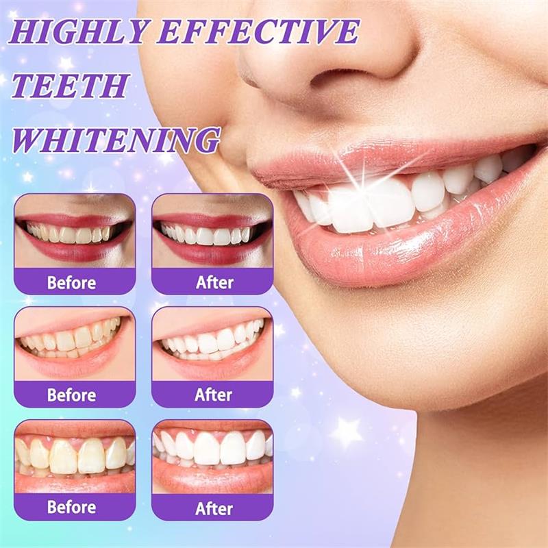 9D 퍼플 치아 미백 치약 무스, 누런 치아 및 플라그 - Teeth Whitening That Works 리뷰 및 가격