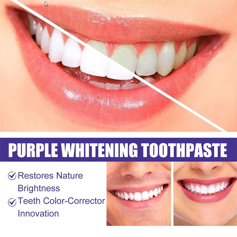 9D 퍼플 치아 미백 치약 무스, 누런 치아 및 플라그 - Teeth Whitening That Works 리뷰 및 가격