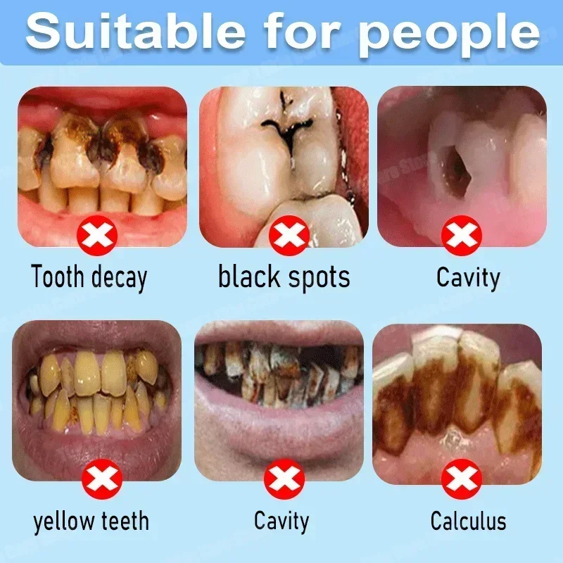 충치 방지 치약은 충치를 복구하고, 충치를 제거하며,  - Teeth Whitening That Works 리뷰 및 가격